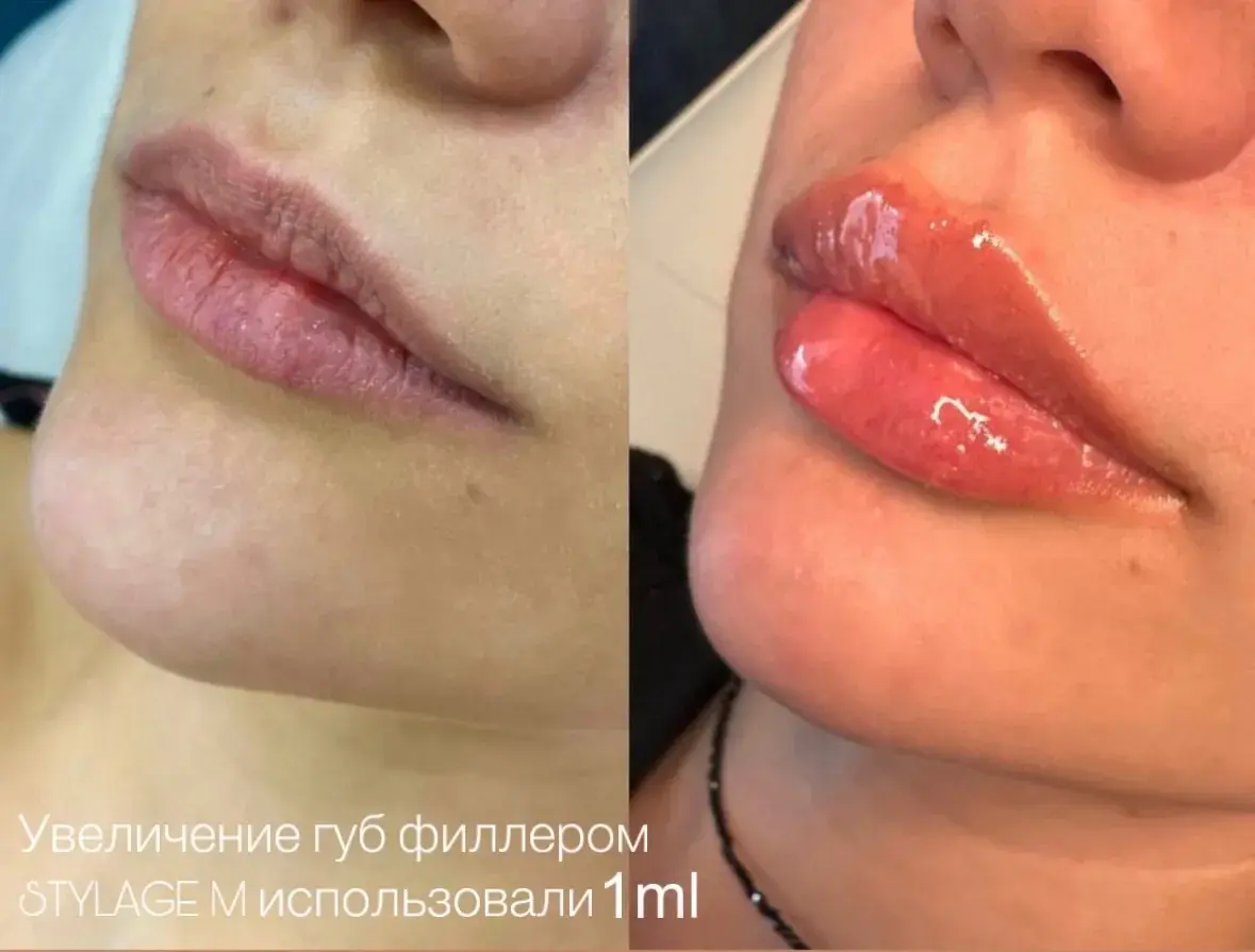 губы